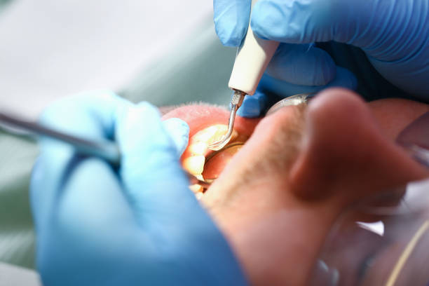 Best Emergency Dental Services for Seniors in Wheeling, WV